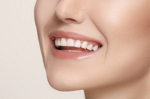 red gums in women